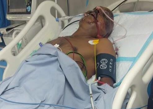 सरैठा गांव के पूर्व दबंग प्रधान के हमले मे घायल युवक की ट्रामा सेंटर मे उपचार के दौरान हुई मौत